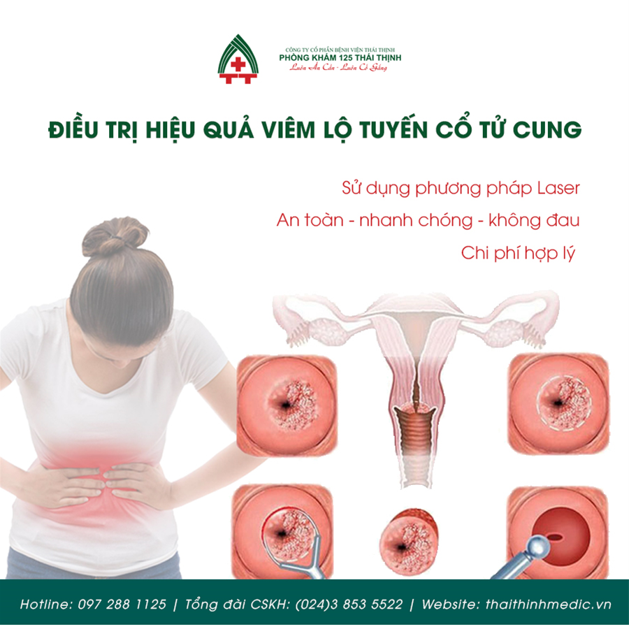 dieu-tri-viem-lo-tuyen-co-tu-cung-bang-phuong-phap-laser-co-gi-noi-bat-1