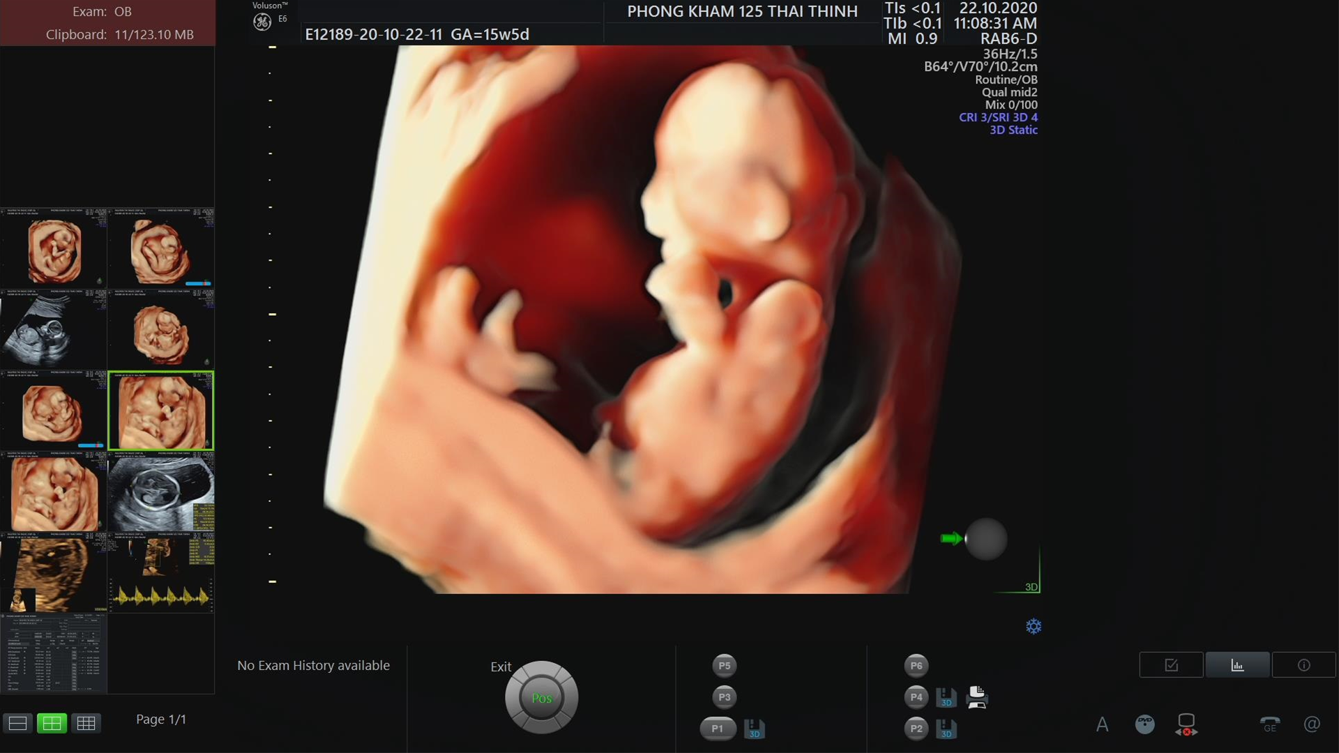 sieu-am-can-nang-thai-nhi-co-chinh-xac-khong-1