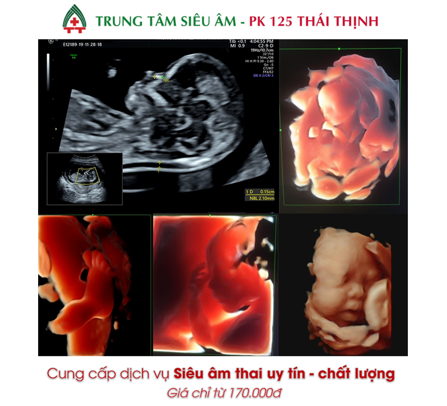nhau-thai-va-nhung-van-de-lien-quan-1