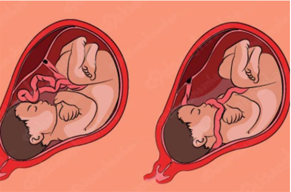 nhung-bat-thuong-ve-day-ron-thuong-gap-2