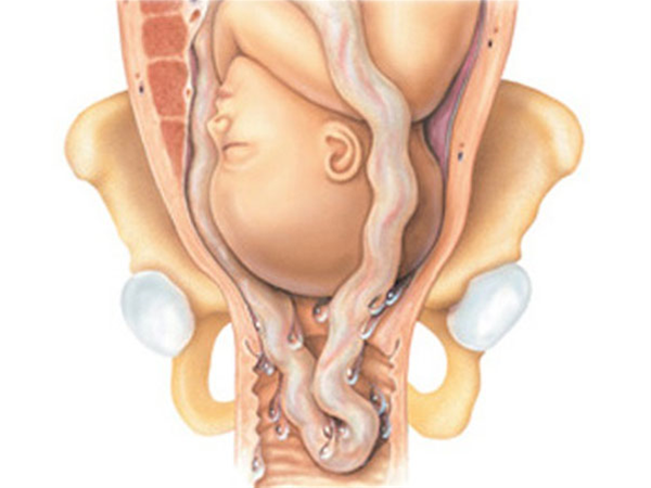 nhung-bat-thuong-ve-day-ron-thuong-gap-4