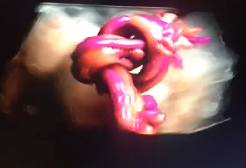 nhung-bat-thuong-ve-day-ron-thuong-gap-3