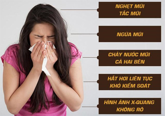 phan-biet-viem-xoang-va-viem-mui-di-ung-1