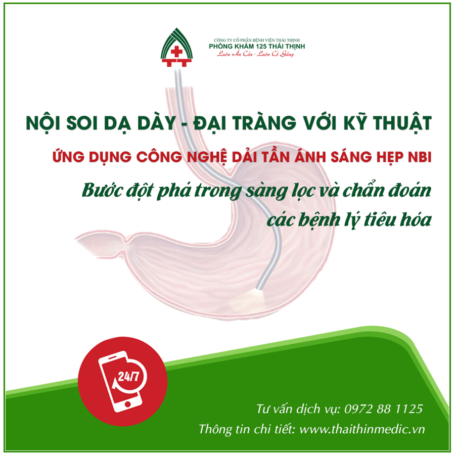 can-noi-soi-tieu-hoa-ngay-khi-co-nhung-dau-hieu-nao-1