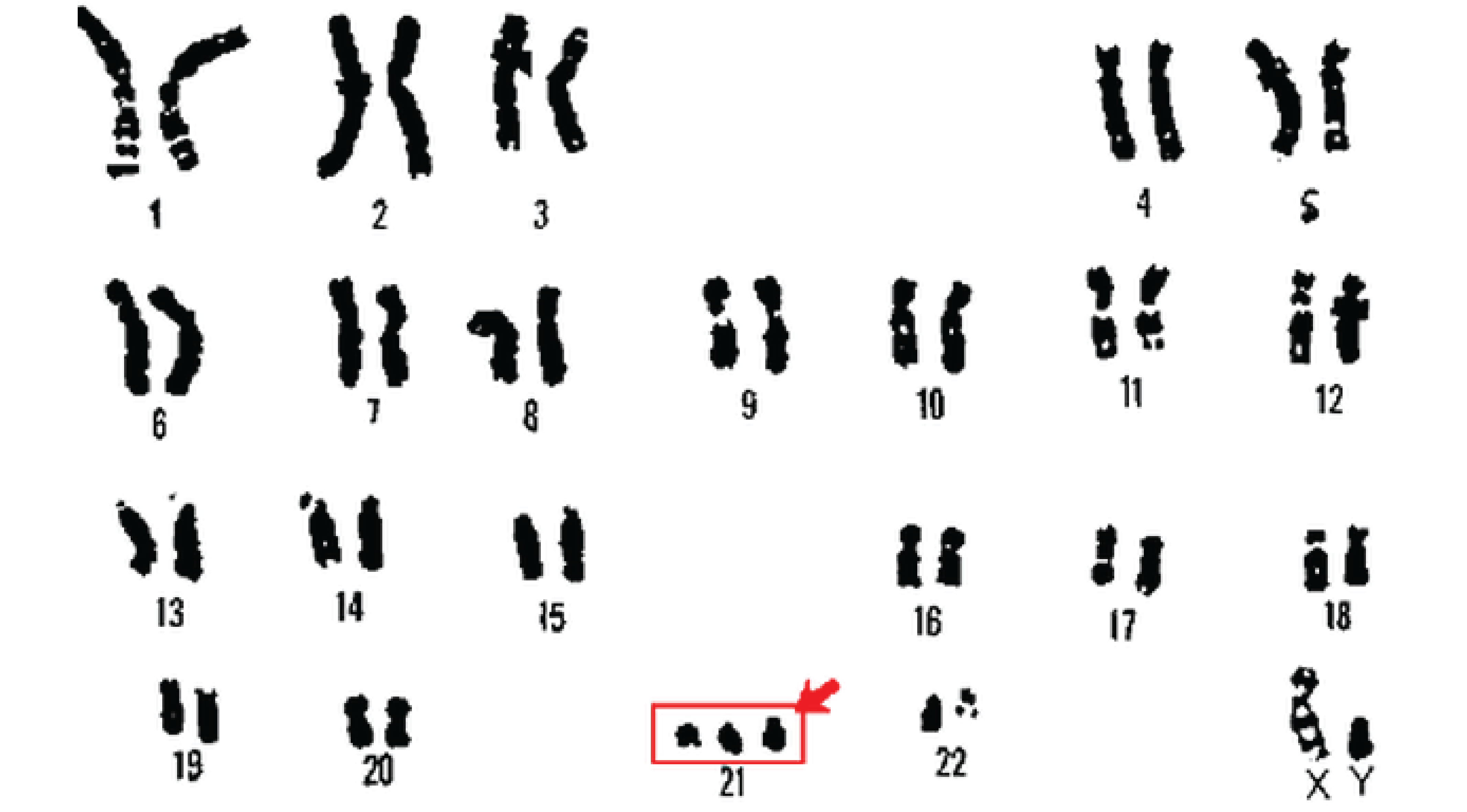 xet-nghiem-nipt