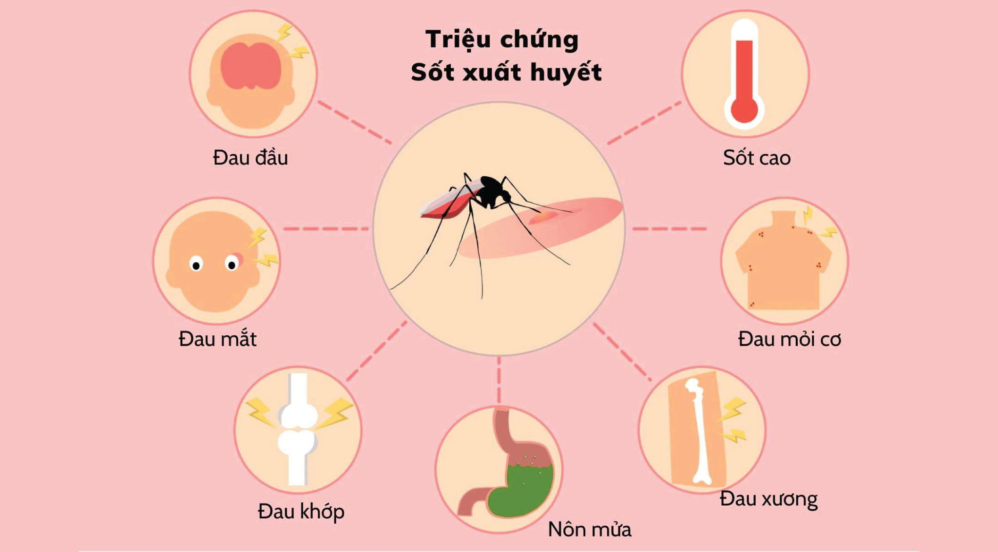nhung-sai-lam-thuong-gap-khien-benh-sot-xuat-huyet-dien-bien-nguy-hiem-2