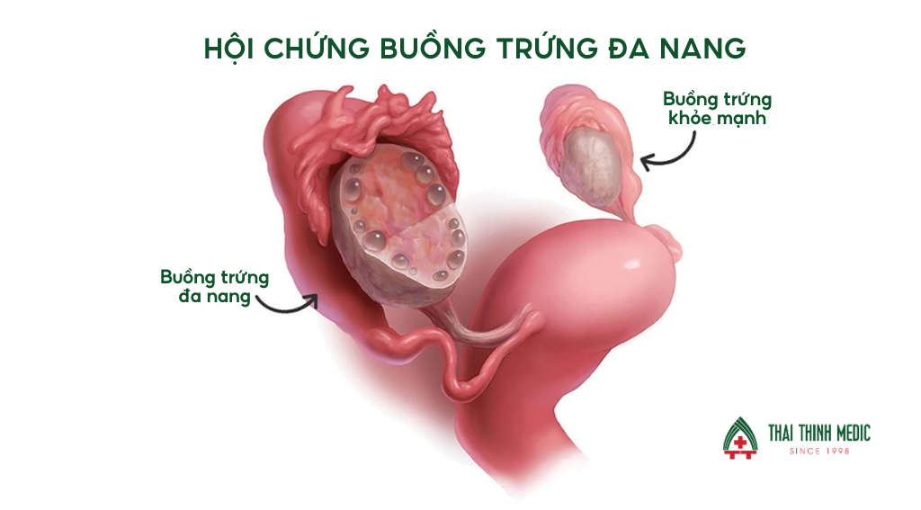 benh-phu-khoa-thuong-gap-o-phu-nu-4