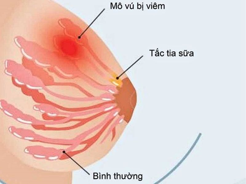 ap-xe-vu-sau-sinh-3