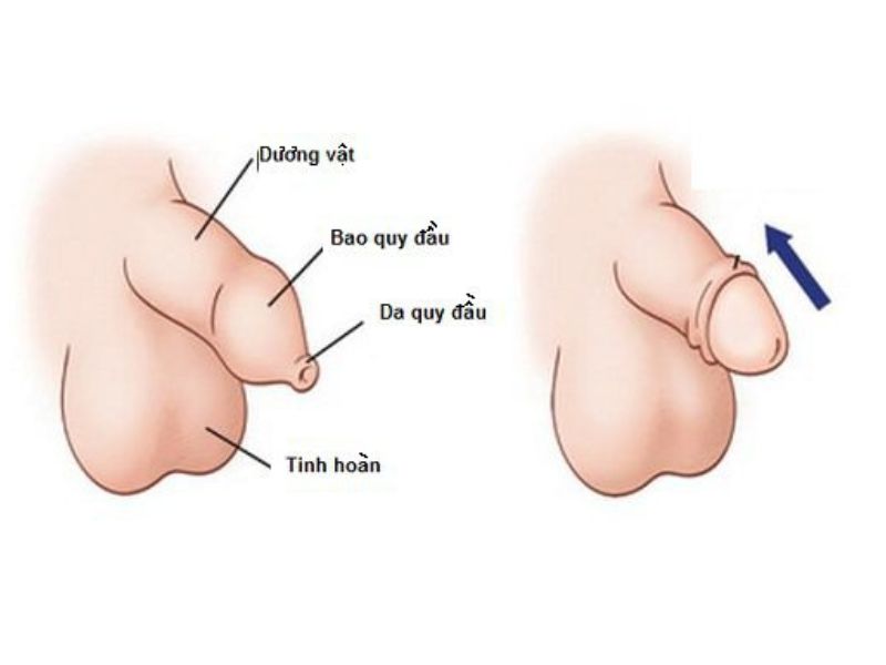 tre-bi-hep-bao-quy-dau-co-nguy-hiem-khong-2