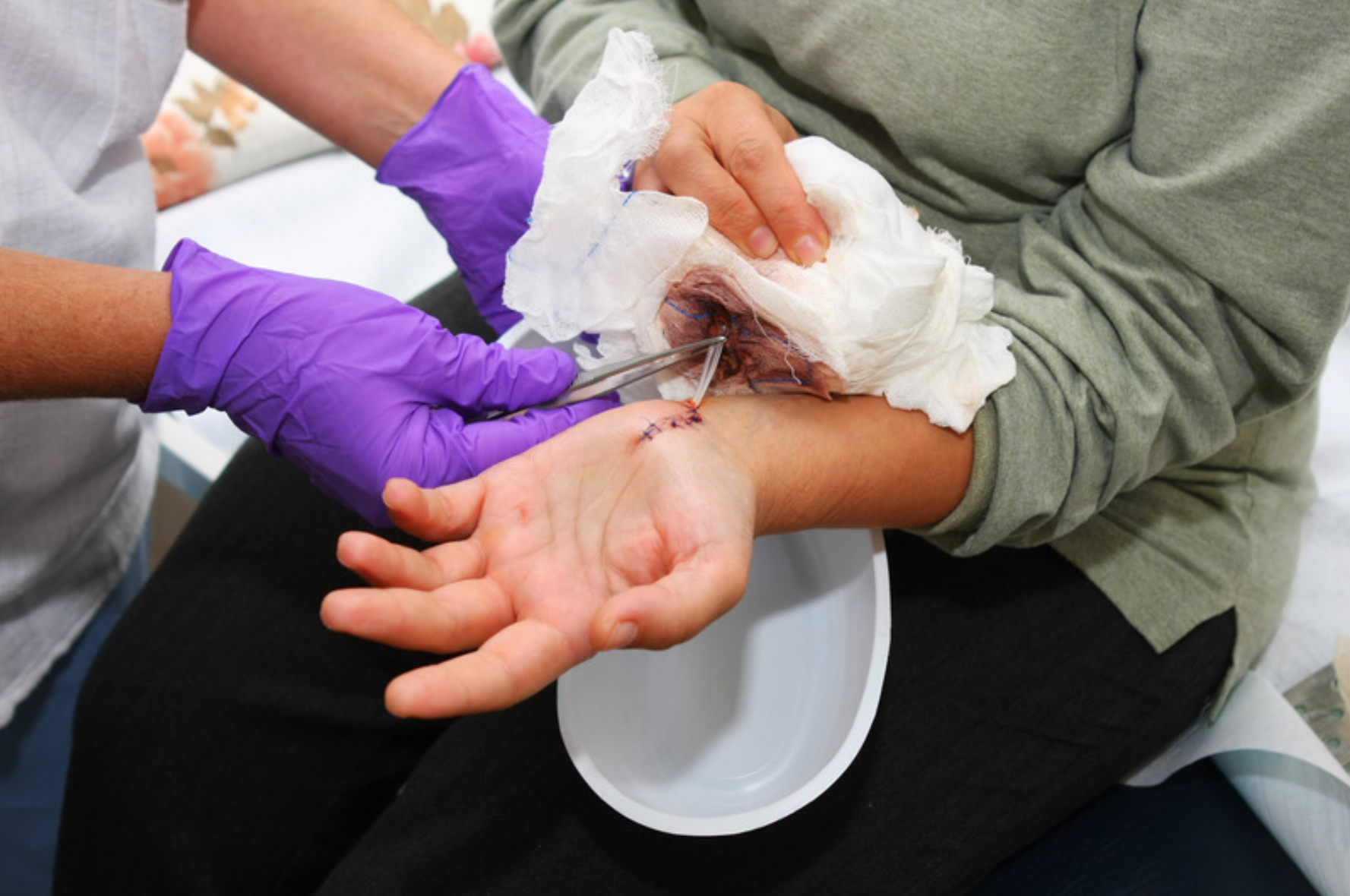 cat-chi-vet-thuong-1