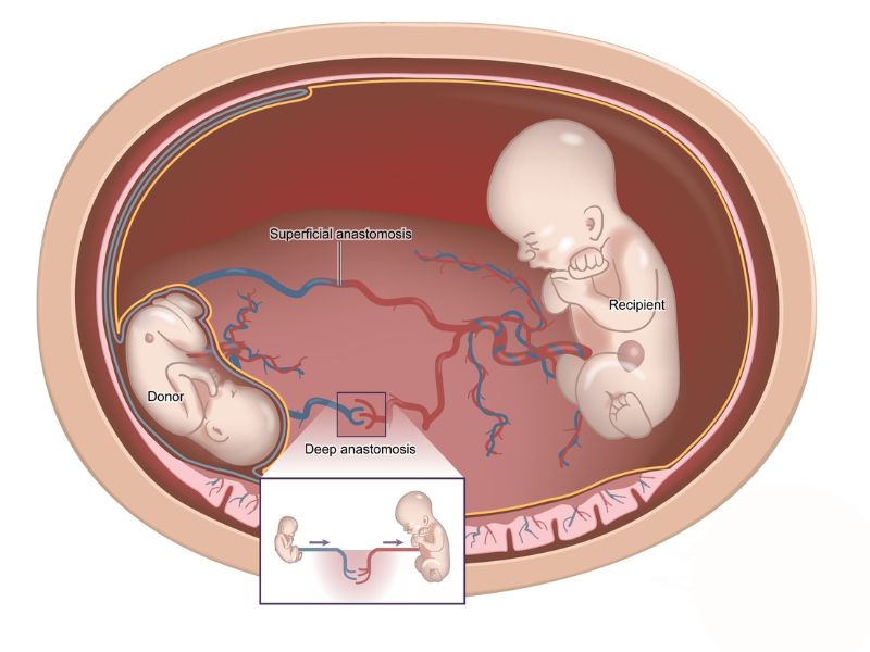 truyen-mau-song-thai-2