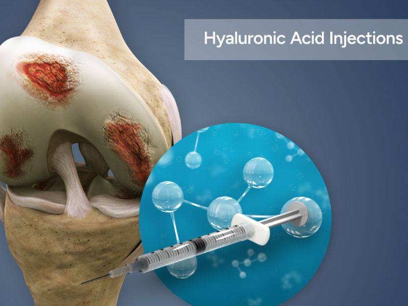 acid-hyaluronic-tiem-khop-2