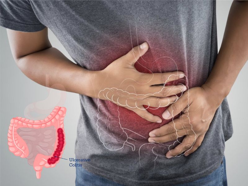 viem-loet-dai-trang-2