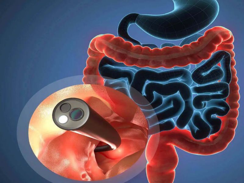 viem-loet-dai-trang-5