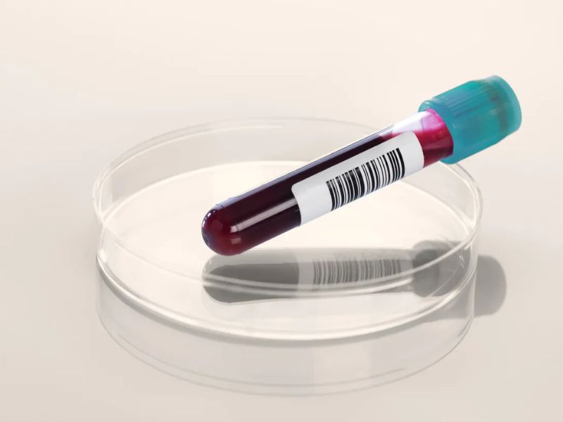 viem-loet-dai-trang-4