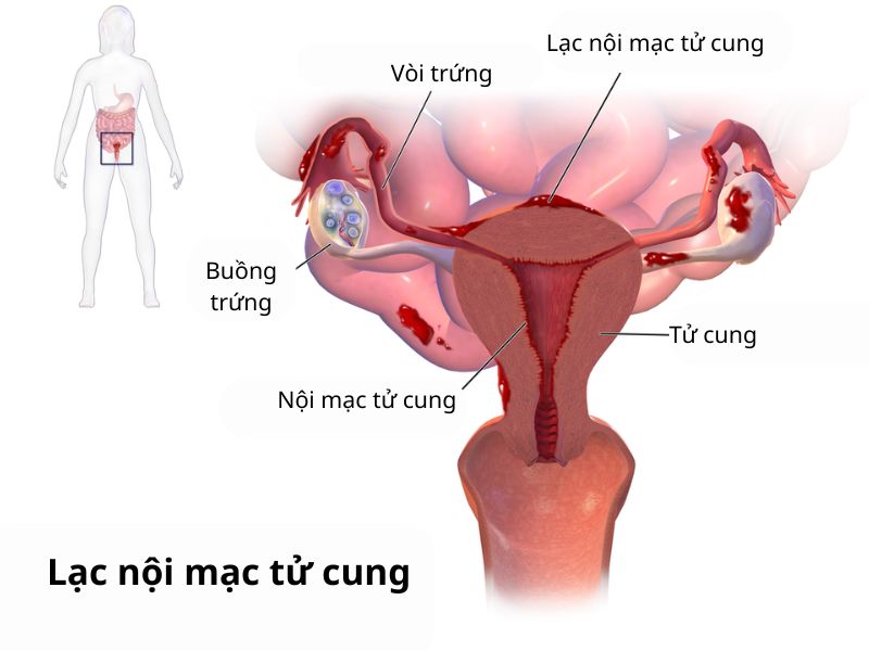 lac-noi-mac-tu-cung-2