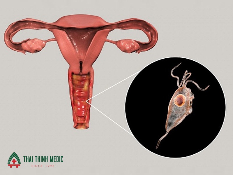 viem-am-dao-co-tu-khoi-khong