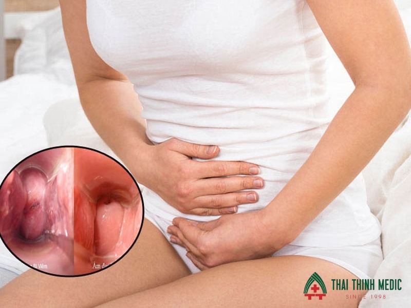 viem-am-dao-co-tu-khoi-khong-giam-trieu-chung