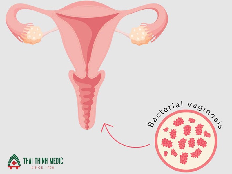 viem-am-dao-do-vi-khuan