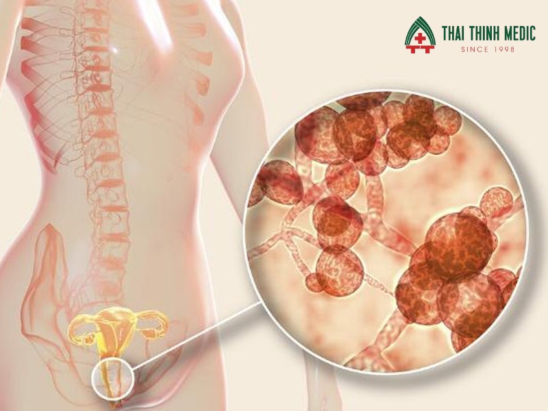 viem-am-dao-do-vi-khuan-cau-hoi