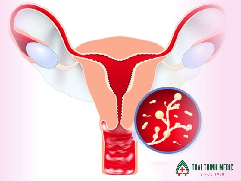 viem-vung-chau-co-nguy-hiem-khong