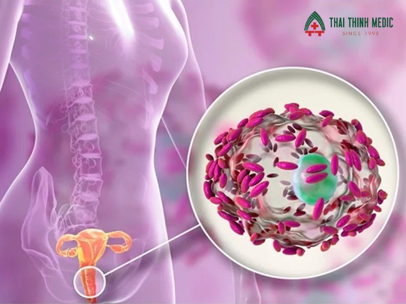 viem-am-dao-tai-phat-dieu-tri-theo-nguyen-nhan