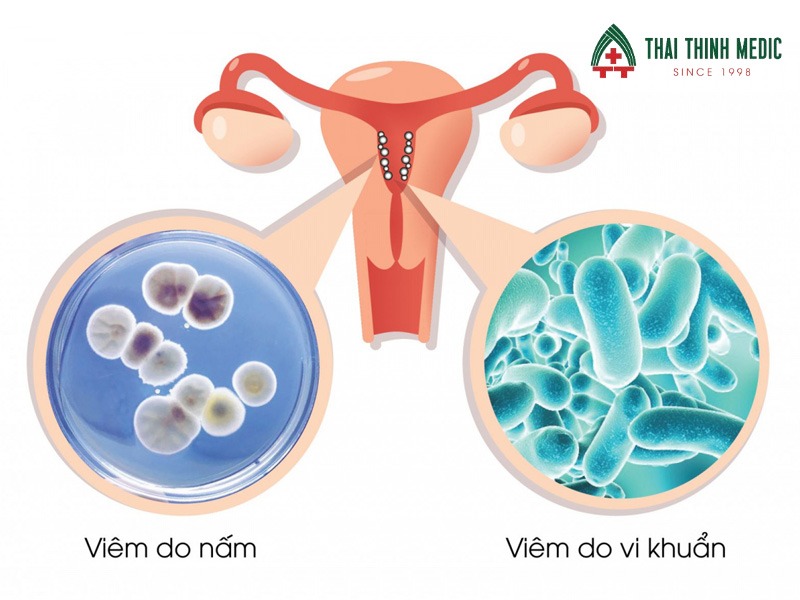 viem-am-dao-tai-phat-dieu-tri
