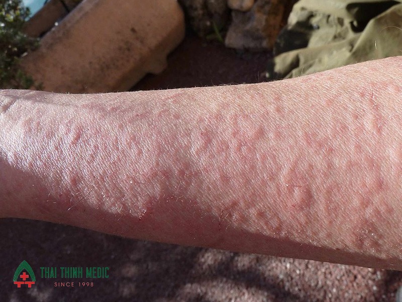 noi-me-day-thoi-tiet