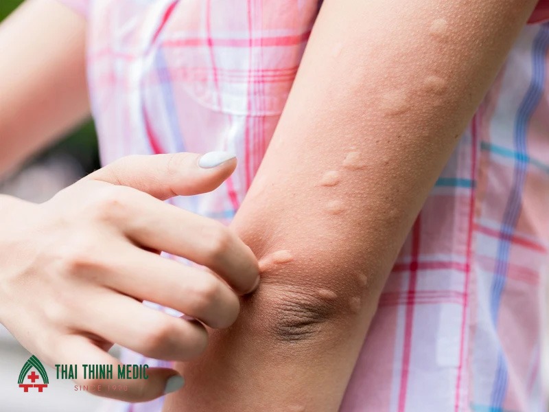 noi-me-day-cong-trung-dot