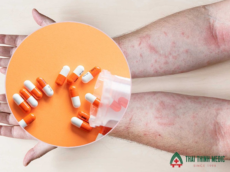 noi-me-day-di-ung-thuoc