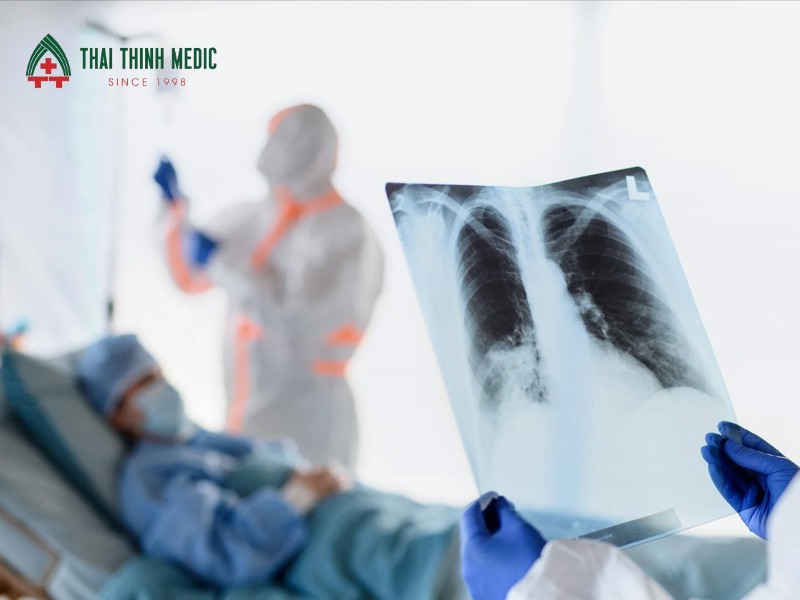 dau-hieu-viem-phoi-nang-nguyen-nhan