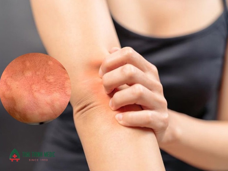 noi-me-day-ve-dem-dau-hieu