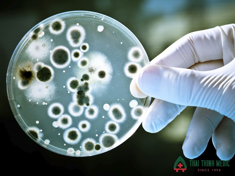 viem-phe-quan-co-lay-khong-do-virus