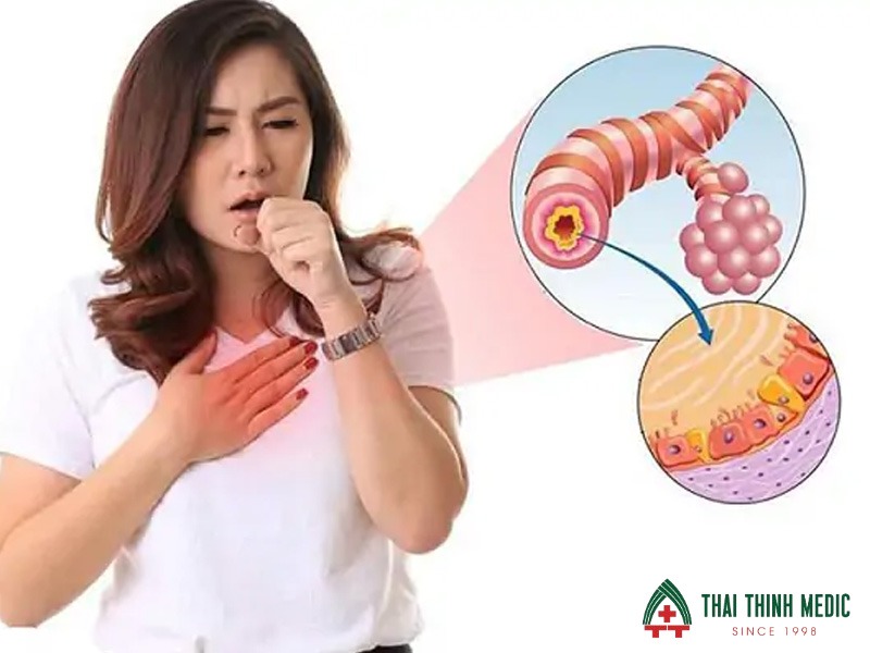 viem-phe-quan-co-lay-khong