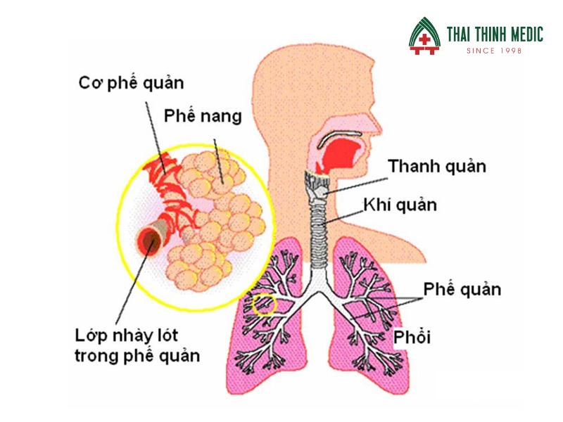 viem-phe-quan-co-lay-khong-viem-phe-quan-cap