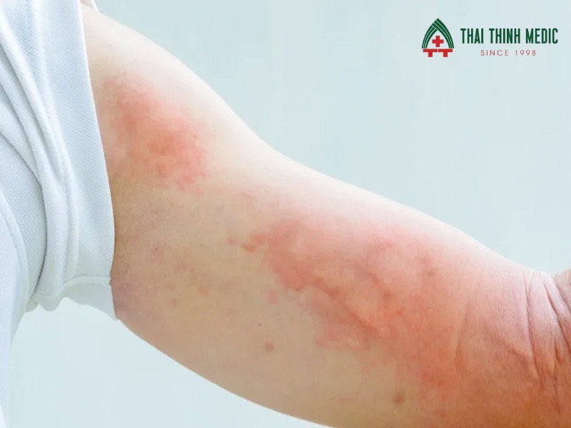 me-day-bao-lau-thi-khoi