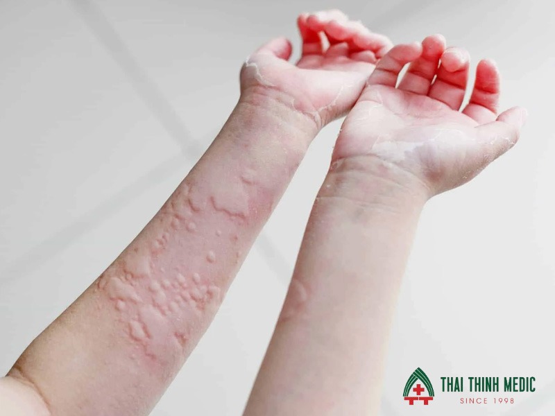 me-day-bao-lau-thi-khoi-cau-hoi