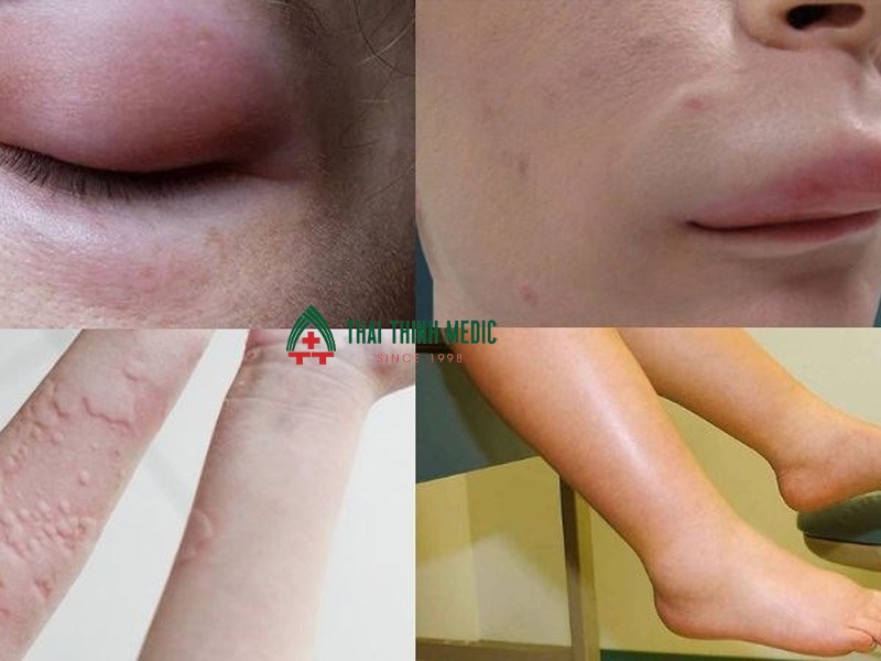 me-day-man-tinh-phu-mach