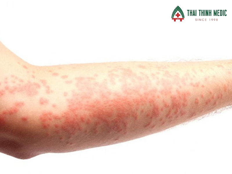 me-day-man-tinh-dau-hieu