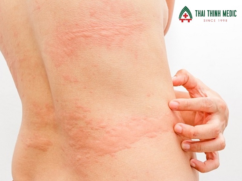 me-day-man-tinh-anh-huong-cuoc-song