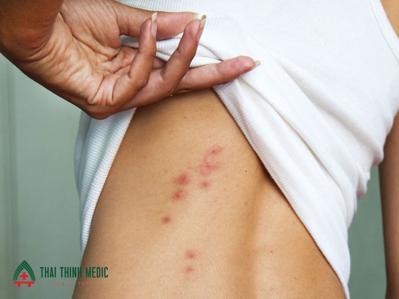 me-day-man-tinh-cau-hoi