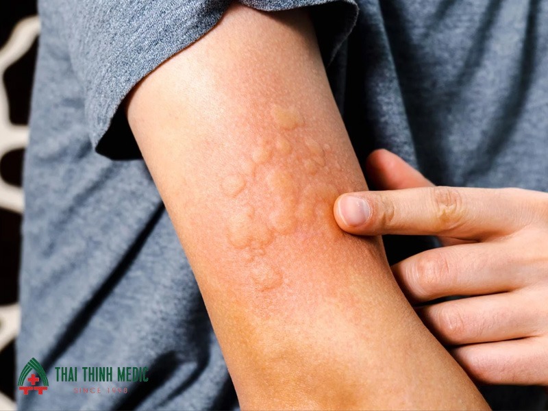 me-day-man-tinh-nenh-ly-nguy-hiem