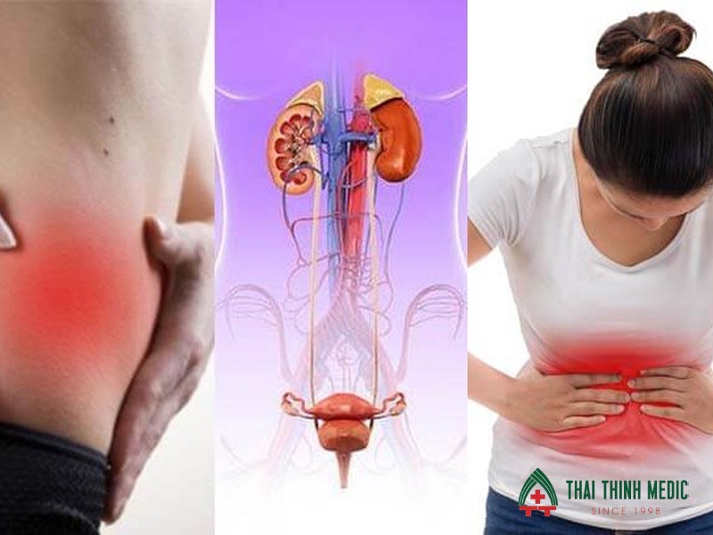 dau-hieu-viem-duong-tiet-nieu-tien-trien