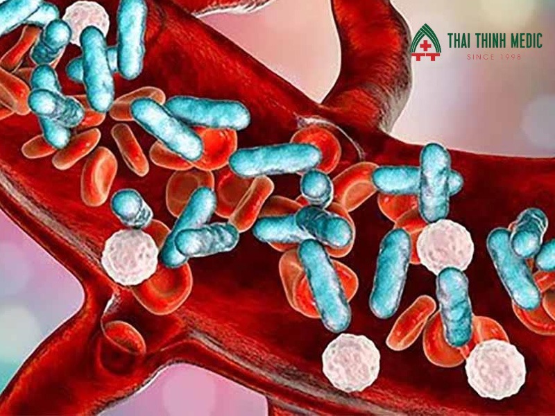 viem-duong-tiet-nieu-co-nguy-hiem-khong-nhiem-trung-mau