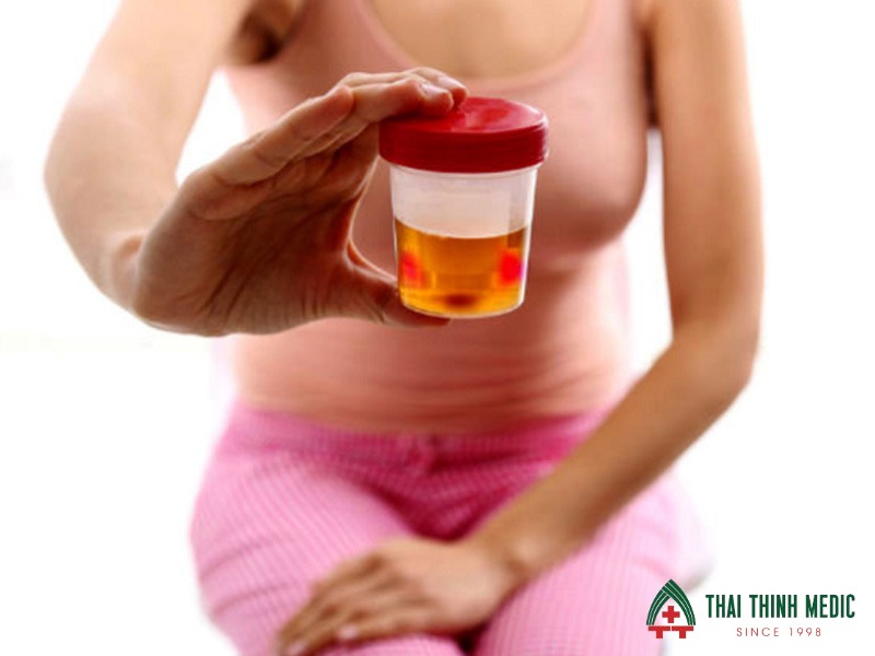 viem-duong-tiet-nieu-co-nguy-hiem-khong-doi-tuong