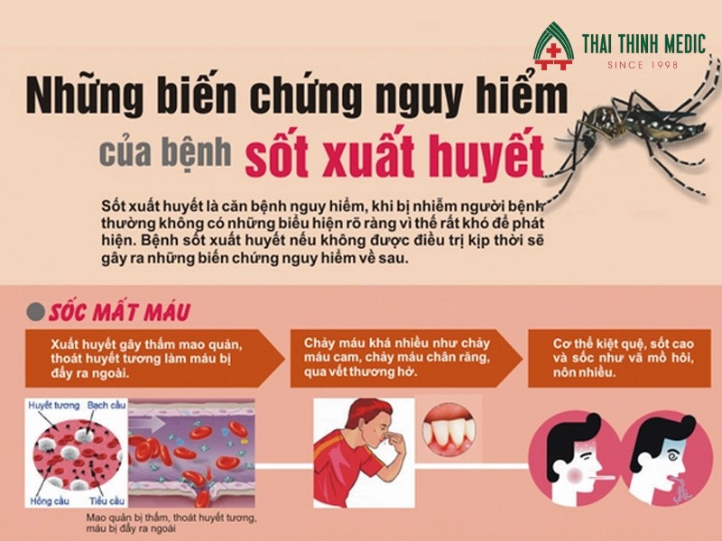 cach-phong-sot-xuat-huyet-bien-chung