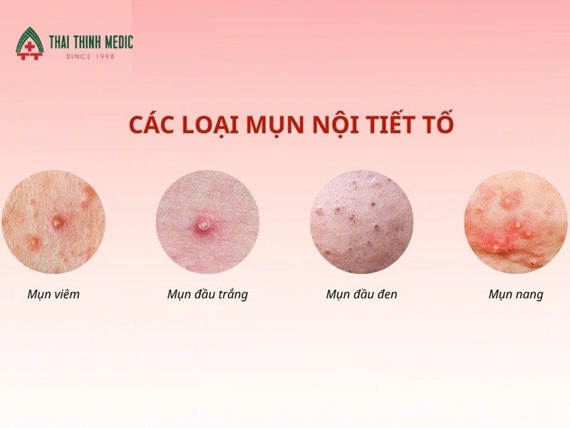 mun-noi-tiet