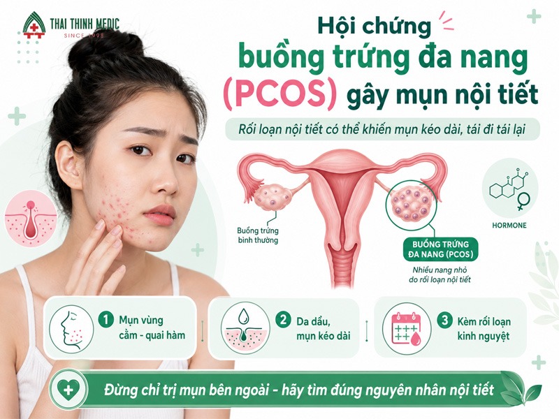 hoi-chung-buong-trung-da-nang-gay-mun-noi-tiet