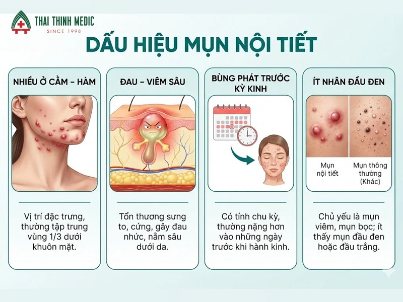 dau-hieu-mun-noi-tiet