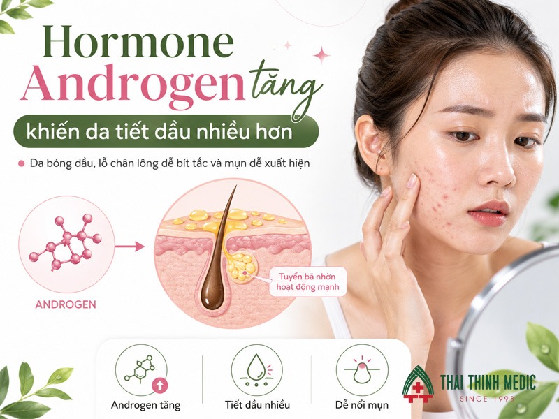 mun-noi-tiet-truoc-ky-kinh-do-hormone-androgen-tang